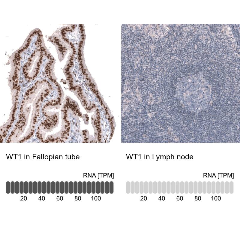 WT1 Antibody (CL13170) - Azide and BSA Free Immunohistochemistry-Paraffin: WT1 Antibody [NBP3-44378]
