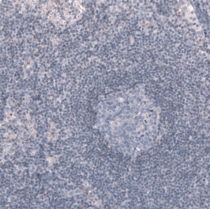 WT1 Antibody (CL13170) - Azide and BSA Free Immunohistochemistry-Paraffin: WT1 Antibody [NBP3-44378]