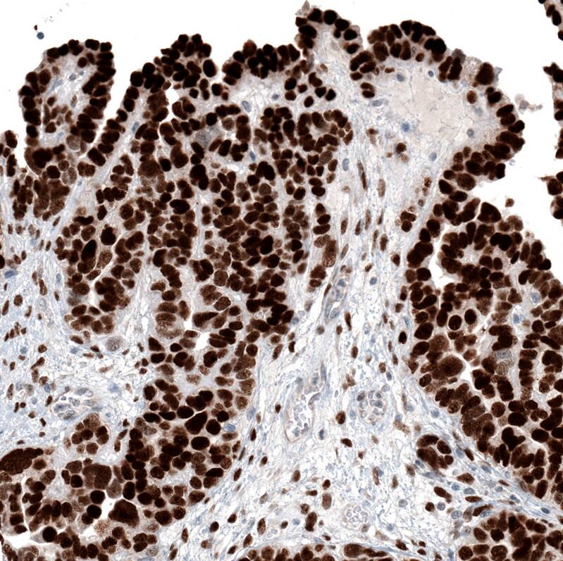 WT1 Antibody (CL13170) - Azide and BSA Free Immunohistochemistry-Paraffin: WT1 Antibody [NBP3-44378]