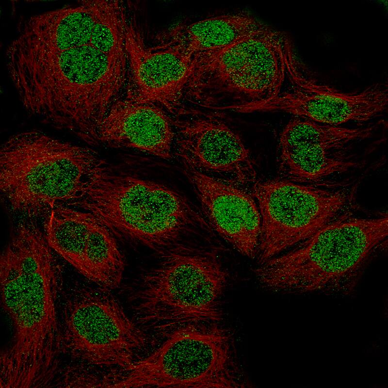 WT1 Antibody (CL13165) - Azide and BSA Free Immunocytochemistry/ Immunofluorescence: WT1 Antibody [NBP3-44379]