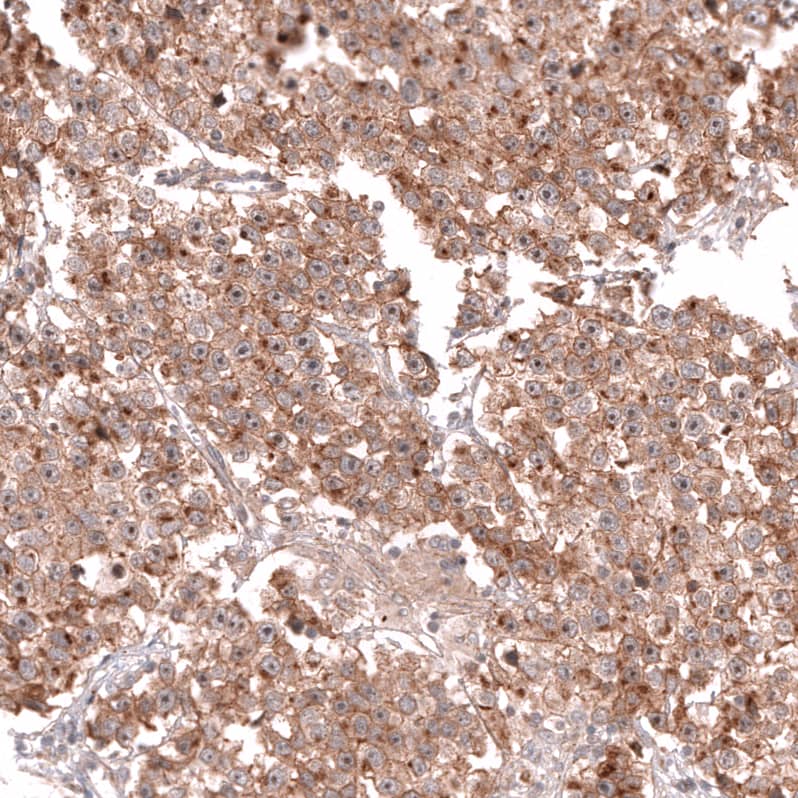 CD30/TNFRSF8 Antibody (CL12632) - Azide and BSA Free Immunohistochemistry-Paraffin: CD30/TNFRSF8 Antibody [NBP3-44380]