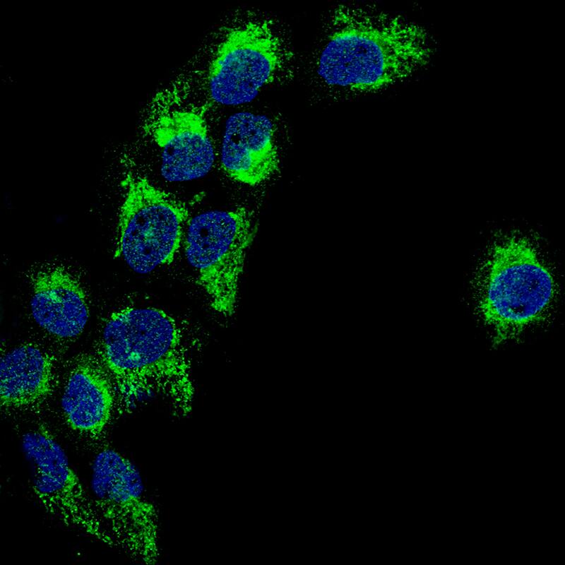PBR Antibody (CL13358) - Azide and BSA Free Immunocytochemistry/ Immunofluorescence: PBR Antibody [NBP3-44381]