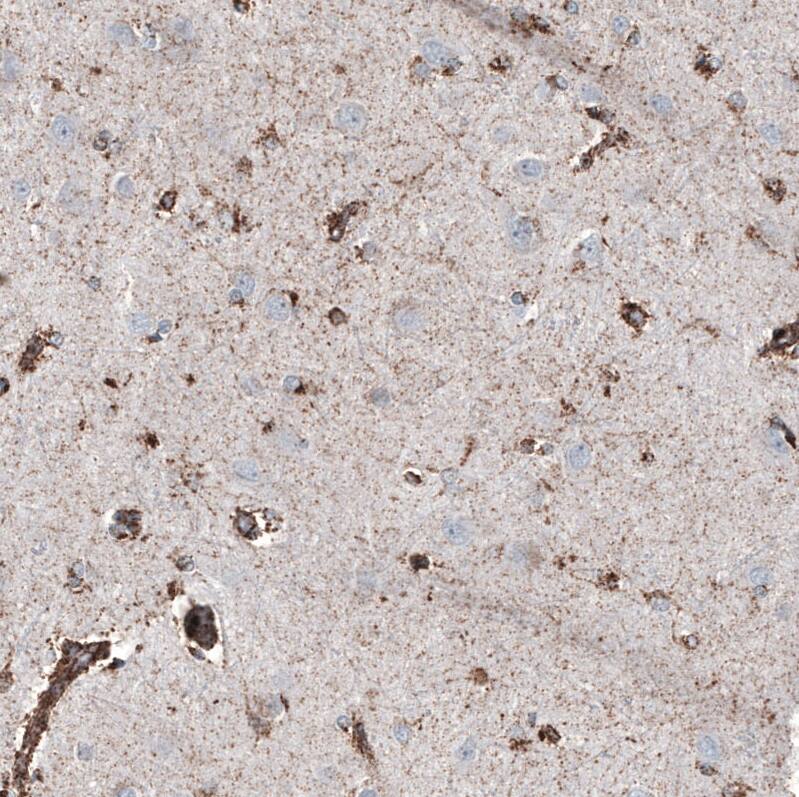 PBR Antibody (CL13358) - Azide and BSA Free Immunohistochemistry-Paraffin: PBR Antibody [NBP3-44381]