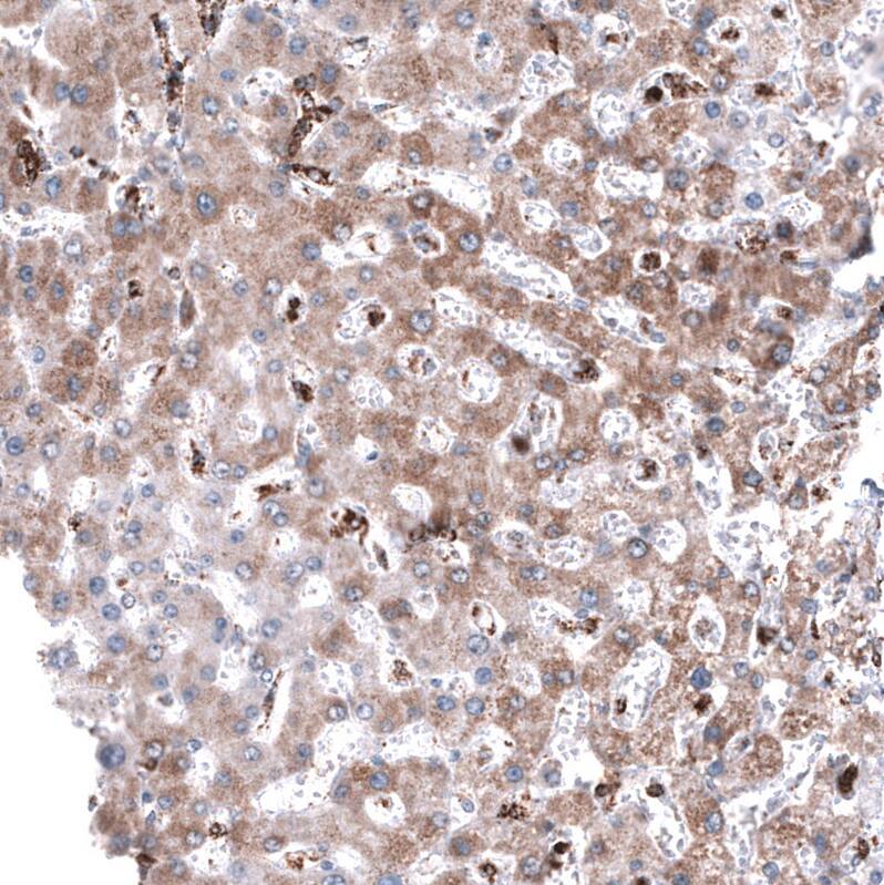 PBR Antibody (CL13358) - Azide and BSA Free Immunohistochemistry-Paraffin: PBR Antibody [NBP3-44381]