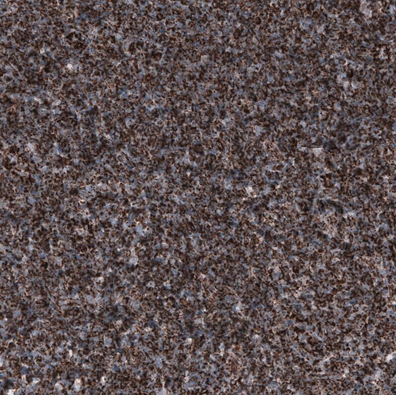 PBR Antibody (CL13358) - Azide and BSA Free Immunohistochemistry-Paraffin: PBR Antibody [NBP3-44381]