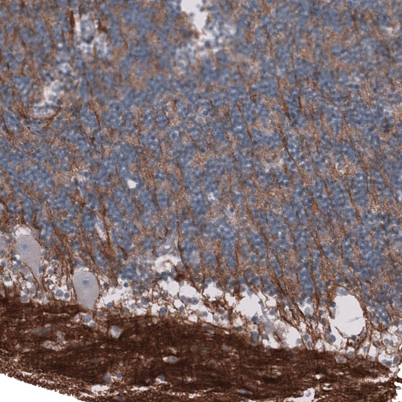 L1CAM Antibody (CL12988) - Azide and BSA Free Immunohistochemistry-Paraffin: L1CAM Antibody [NBP3-44382]