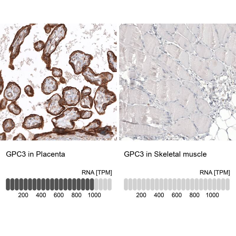 Glypican 3 Antibody (CL12711) - Azide and BSA Free Immunohistochemistry-Paraffin: Glypican 3 Antibody [NBP3-44385]