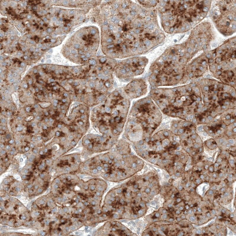 Glypican 3 Antibody (CL12711) - Azide and BSA Free Immunohistochemistry-Paraffin: Glypican 3 Antibody [NBP3-44385]