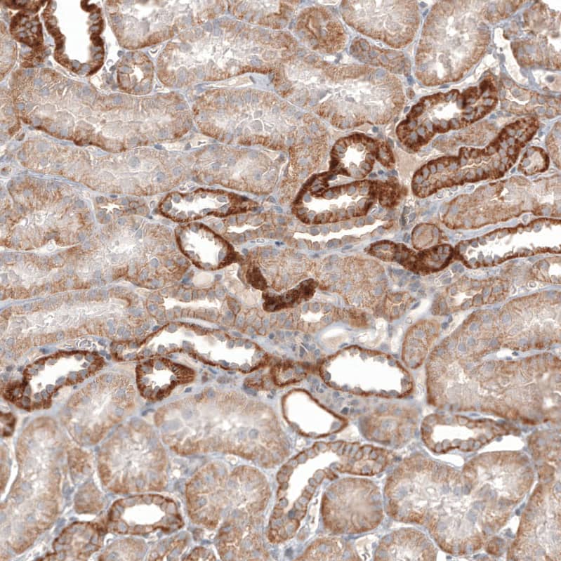 Glypican 3 Antibody (CL12711) - Azide and BSA Free Immunohistochemistry-Paraffin: Glypican 3 Antibody [NBP3-44385]