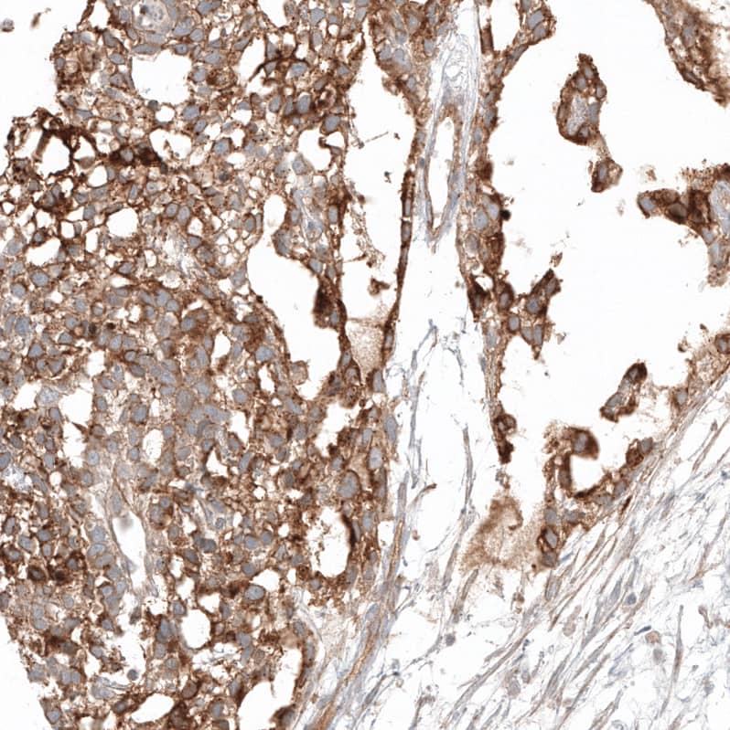 Glypican 3 Antibody (CL12711) - Azide and BSA Free Immunohistochemistry-Paraffin: Glypican 3 Antibody [NBP3-44385]
