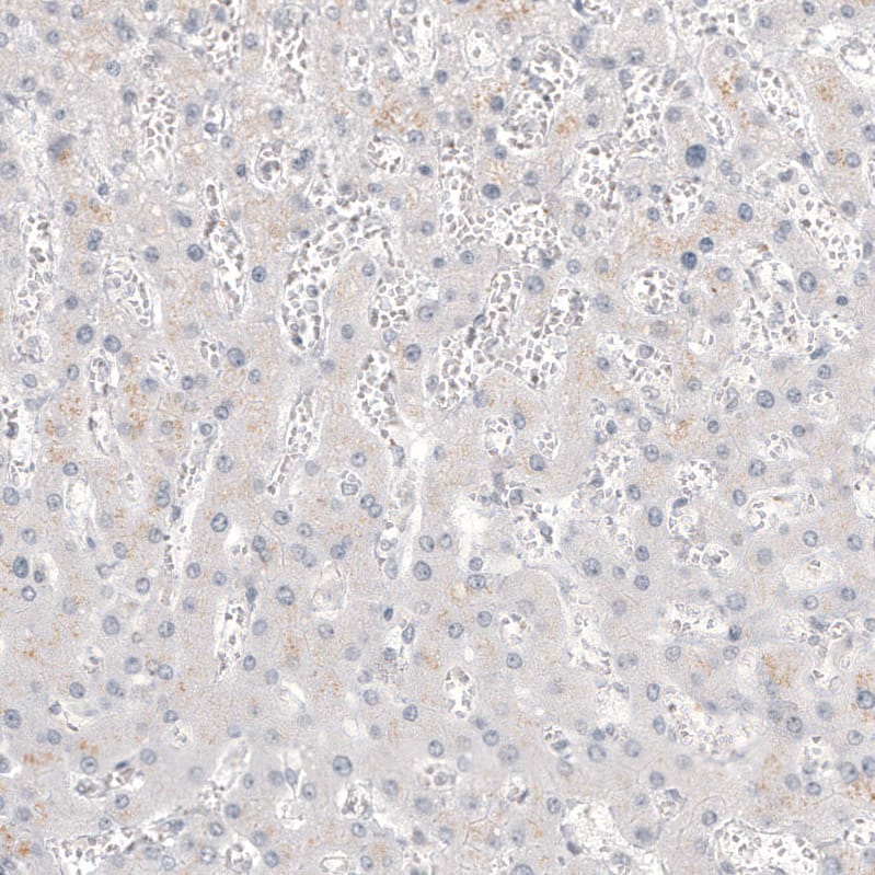 Glypican 3 Antibody (CL12711) - Azide and BSA Free Immunohistochemistry-Paraffin: Glypican 3 Antibody [NBP3-44385]