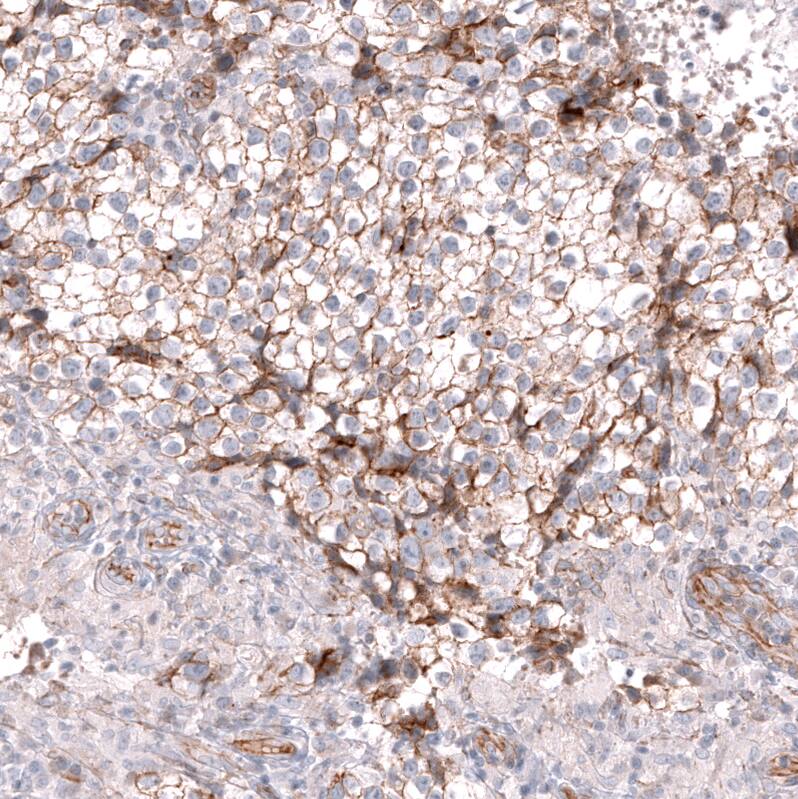 Glypican 3 Antibody (CL12711) - Azide and BSA Free Immunohistochemistry-Paraffin: Glypican 3 Antibody [NBP3-44385]