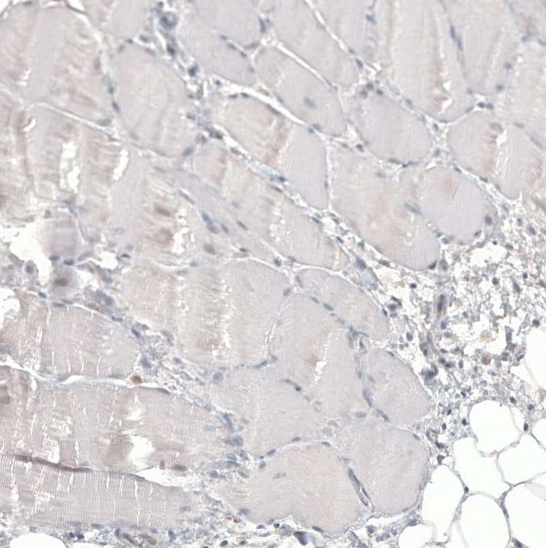 Glypican 3 Antibody (CL12711) - Azide and BSA Free Immunohistochemistry-Paraffin: Glypican 3 Antibody [NBP3-44385]