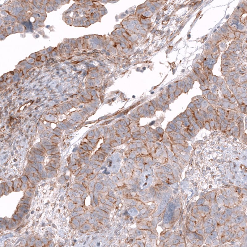 Glypican 3 Antibody (CL12711) - Azide and BSA Free Immunohistochemistry-Paraffin: Glypican 3 Antibody [NBP3-44385]