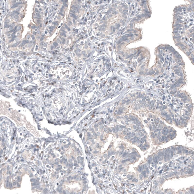 FOXL2 Antibody (CL12762) - Azide and BSA Free Immunohistochemistry-Paraffin: FOXL2 Antibody [NBP3-44386]