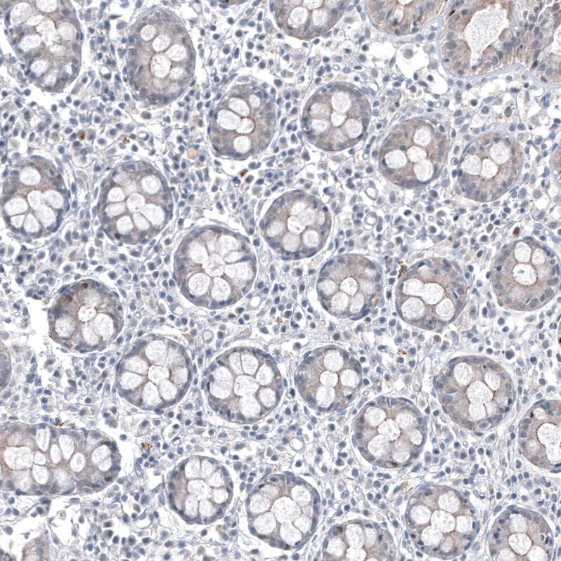 FOXL2 Antibody (CL12762) - Azide and BSA Free Immunohistochemistry-Paraffin: FOXL2 Antibody [NBP3-44386]