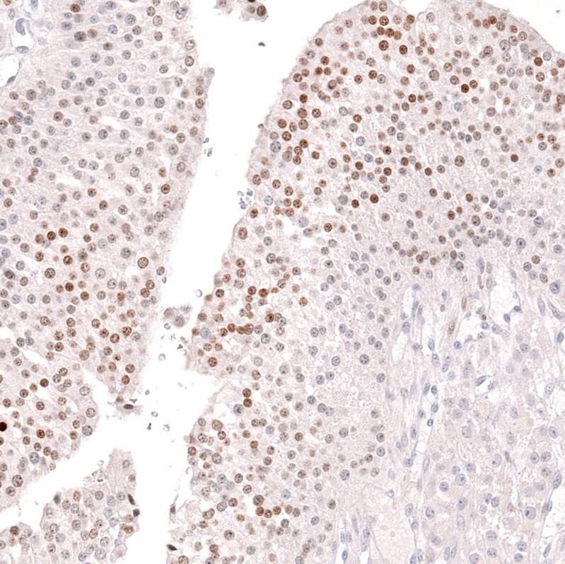 FOXL2 Antibody (CL12762) - Azide and BSA Free Immunohistochemistry-Paraffin: FOXL2 Antibody [NBP3-44386]