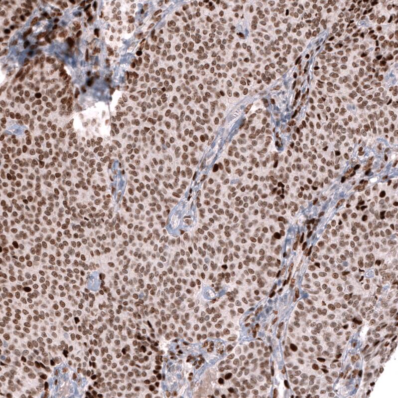 FOXL2 Antibody (CL12762) - Azide and BSA Free Immunohistochemistry-Paraffin: FOXL2 Antibody [NBP3-44386]