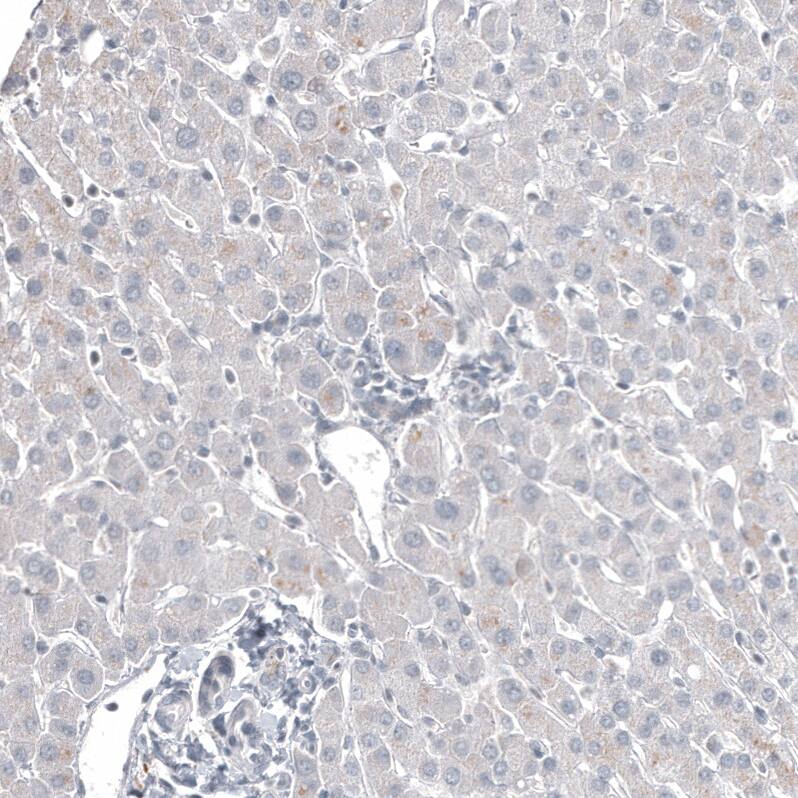 FOXL2 Antibody (CL12762) - Azide and BSA Free Immunohistochemistry-Paraffin: FOXL2 Antibody [NBP3-44386]