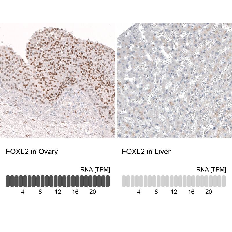 FOXL2 Antibody (CL12753) - Azide and BSA Free Immunohistochemistry-Paraffin: FOXL2 Antibody [NBP3-44387]