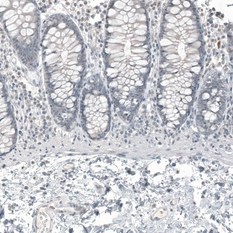 FOXL2 Antibody (CL12753) - Azide and BSA Free Immunohistochemistry-Paraffin: FOXL2 Antibody [NBP3-44387]