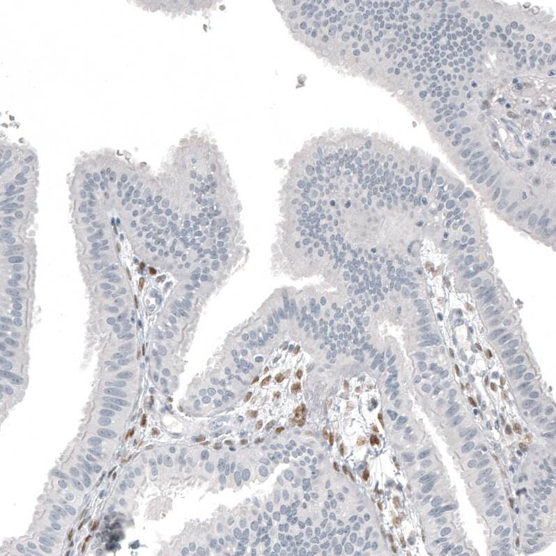 FOXL2 Antibody (CL12753) - Azide and BSA Free Immunohistochemistry-Paraffin: FOXL2 Antibody [NBP3-44387]