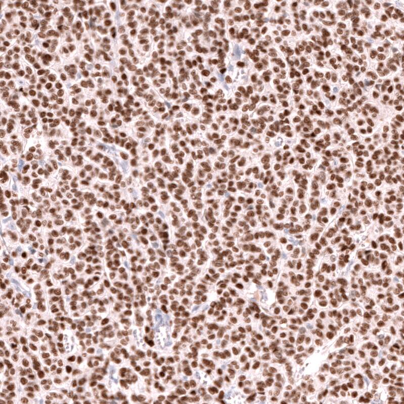 FOXL2 Antibody (CL12753) - Azide and BSA Free Immunohistochemistry-Paraffin: FOXL2 Antibody [NBP3-44387]