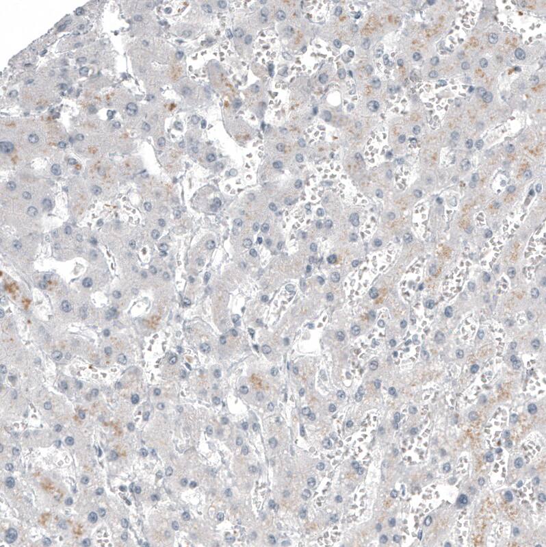 FOXL2 Antibody (CL12753) - Azide and BSA Free Immunohistochemistry-Paraffin: FOXL2 Antibody [NBP3-44387]