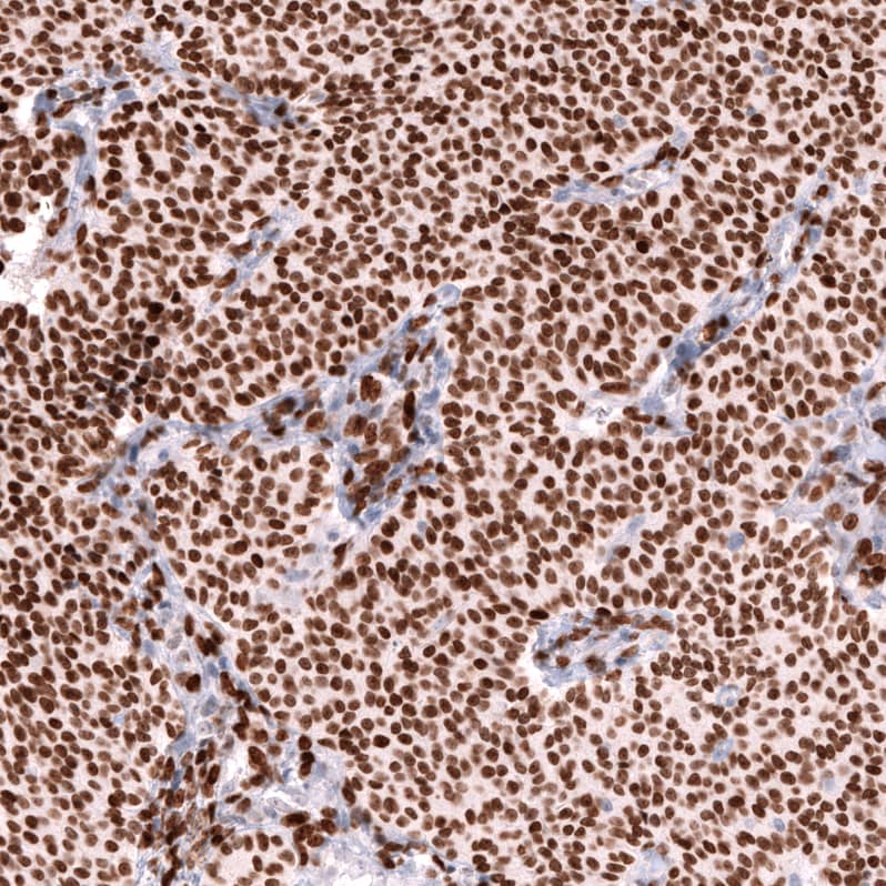 FOXL2 Antibody (CL12753) - Azide and BSA Free Immunohistochemistry-Paraffin: FOXL2 Antibody [NBP3-44387]
