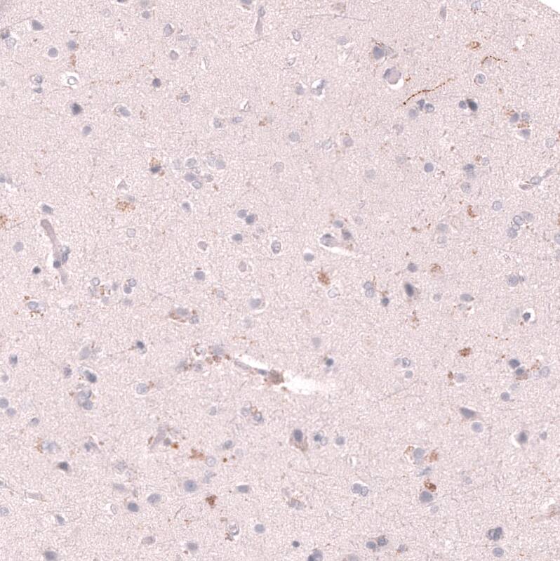 VMAT2 Antibody (CL13157) - Azide and BSA Free Immunohistochemistry-Paraffin: VMAT2 Antibody [NBP3-44388]