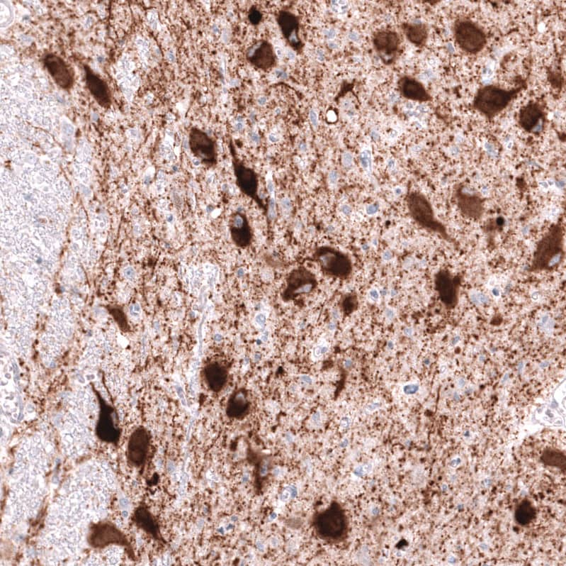 VMAT2 Antibody (CL13157) - Azide and BSA Free Immunohistochemistry-Paraffin: VMAT2 Antibody [NBP3-44388]