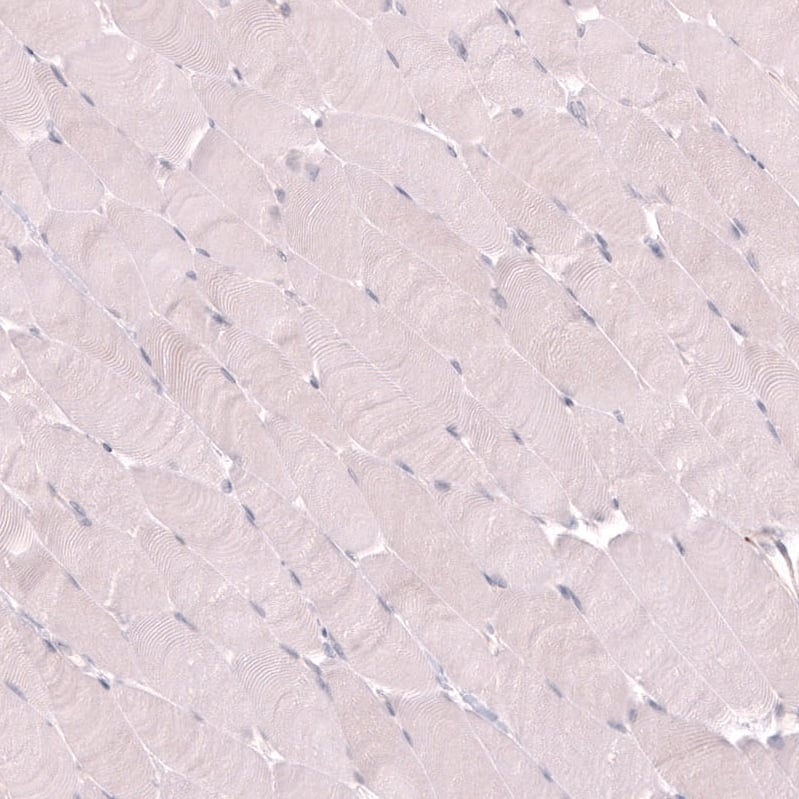 VMAT2 Antibody (CL13157) - Azide and BSA Free Immunohistochemistry-Paraffin: VMAT2 Antibody [NBP3-44388]