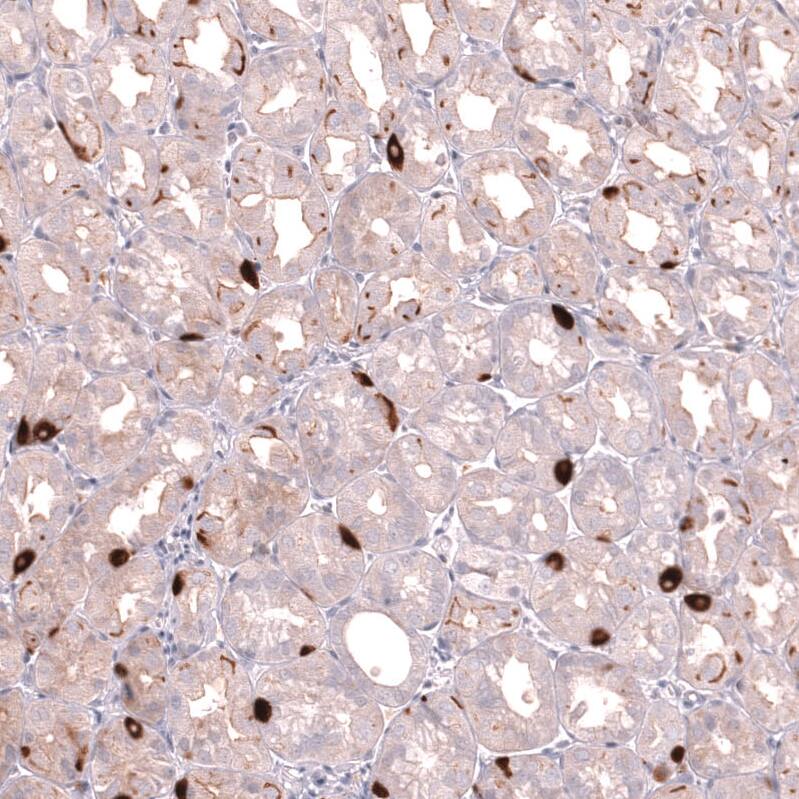 VMAT2 Antibody (CL13157) - Azide and BSA Free Immunohistochemistry-Paraffin: VMAT2 Antibody [NBP3-44388]