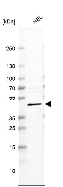 VMAT2 Antibody (CL13157) - Azide and BSA Free Western Blot: VMAT2 Antibody [NBP3-44388]