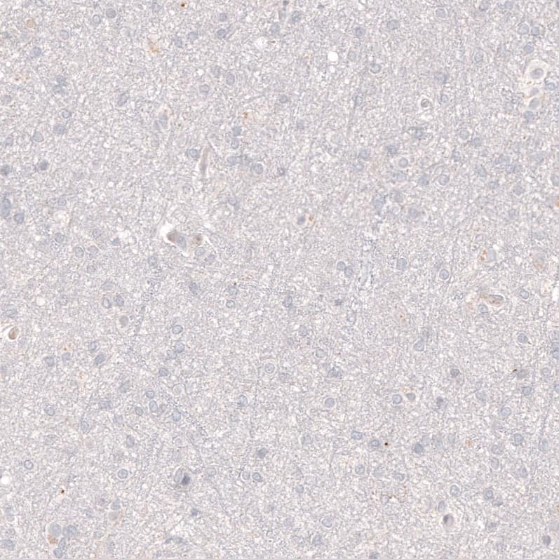 VMAT2 Antibody (CL12531) - Azide and BSA Free Immunohistochemistry-Paraffin: VMAT2 Antibody [NBP3-44389]