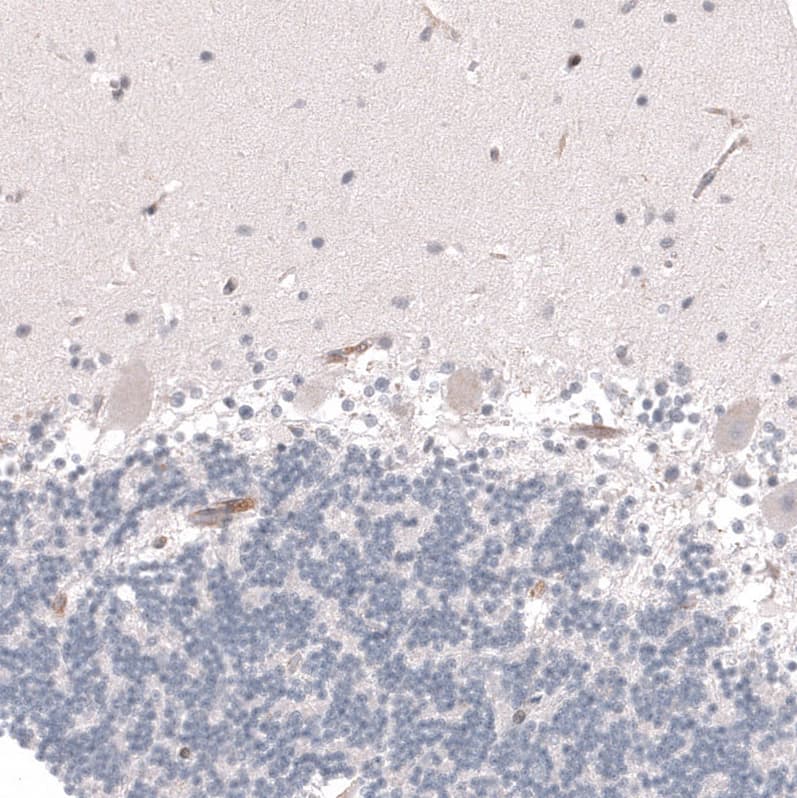 VMAT2 Antibody (CL12531) - Azide and BSA Free Immunohistochemistry-Paraffin: VMAT2 Antibody [NBP3-44389]