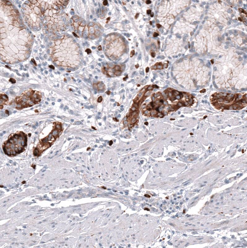 VMAT2 Antibody (CL12531) - Azide and BSA Free Immunohistochemistry-Paraffin: VMAT2 Antibody [NBP3-44389]