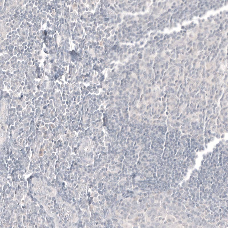 CDX2 Antibody (CL12974) - Azide and BSA Free Immunohistochemistry-Paraffin: CDX2 Antibody [NBP3-44391]