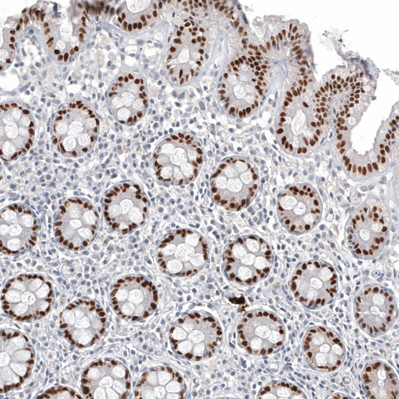 CDX2 Antibody (CL12974) - Azide and BSA Free Immunohistochemistry-Paraffin: CDX2 Antibody [NBP3-44391]