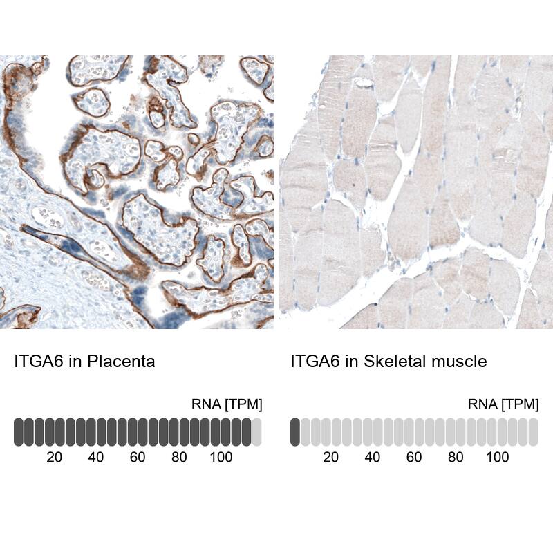 Integrin alpha 6/CD49f Antibody (CL6957) - Azide and BSA Free Immunohistochemistry-Paraffin: Integrin alpha 6/CD49f Antibody [NBP3-44394]