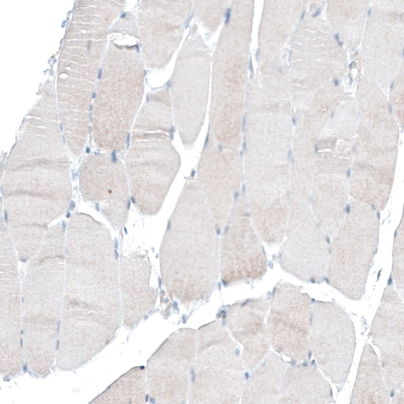 Integrin alpha 6/CD49f Antibody (CL6957) - Azide and BSA Free Immunohistochemistry-Paraffin: Integrin alpha 6/CD49f Antibody [NBP3-44394]