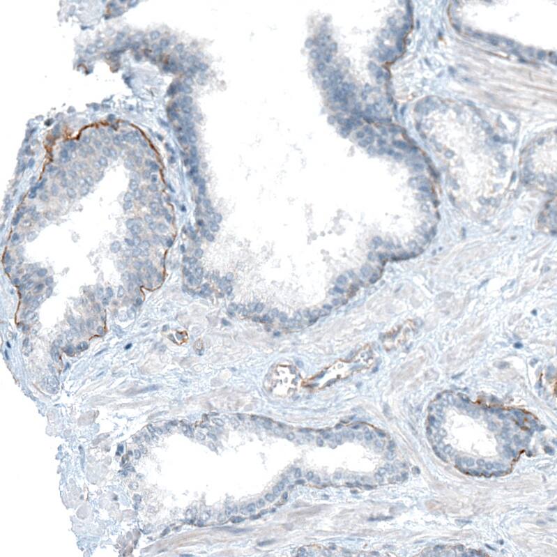 Integrin alpha 6/CD49f Antibody (CL6957) - Azide and BSA Free Immunohistochemistry-Paraffin: Integrin alpha 6/CD49f Antibody [NBP3-44394]