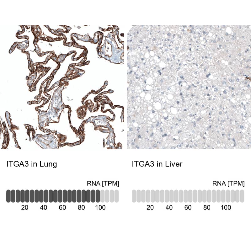 Integrin alpha 3/CD49c Antibody (CL6937) - Azide and BSA Free Immunohistochemistry-Paraffin: Integrin alpha 3/CD49c Antibody [NBP3-44395]