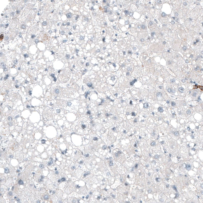 Integrin alpha 3/CD49c Antibody (CL6937) - Azide and BSA Free Immunohistochemistry-Paraffin: Integrin alpha 3/CD49c Antibody [NBP3-44395]