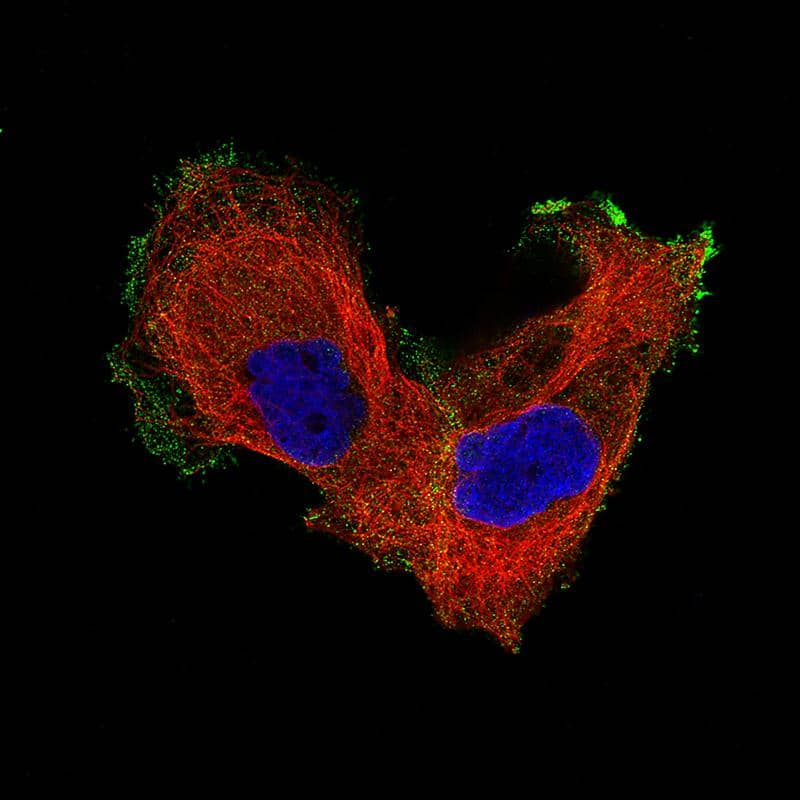 Integrin beta 8 Antibody (CL7290) - Azide and BSA Free Immunocytochemistry/ Immunofluorescence: Integrin beta 8 Antibody [NBP3-44396]