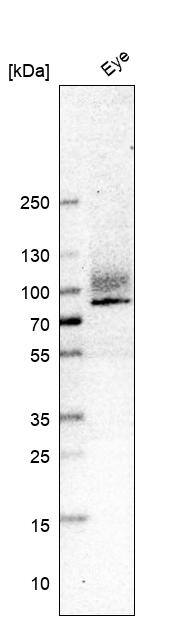 Integrin beta 8 Antibody (CL7290) - Azide and BSA Free Western Blot: Integrin beta 8 Antibody [NBP3-44396]