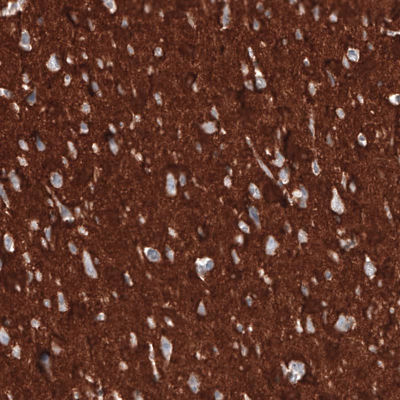 CD47 Antibody (CL6913) - Azide and BSA Free Immunohistochemistry-Paraffin: CD47 Antibody [NBP3-44397]