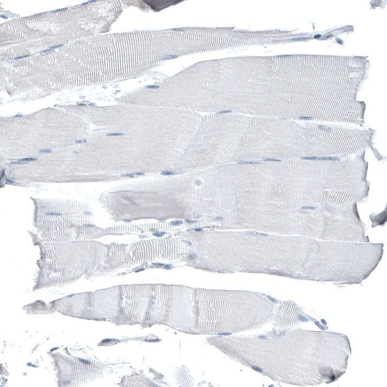 CD47 Antibody (CL6913) - Azide and BSA Free Immunohistochemistry-Paraffin: CD47 Antibody [NBP3-44397]