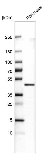 Carboxypeptidase A1/CPA1 Antibody (CL6607) - Azide and BSA Free Western Blot: Carboxypeptidase A1/CPA1 Antibody [NBP3-44398]
