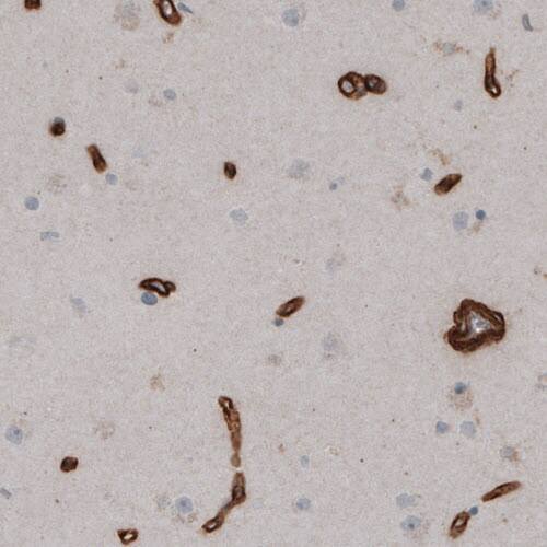 Laminin S/Laminin beta 2 Antibody (CL2976) - Azide and BSA Free Immunohistochemistry-Paraffin: Laminin S/Laminin beta 2 Antibody [NBP3-44400]